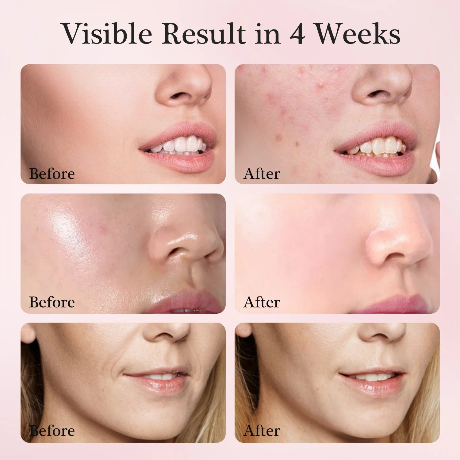 ED Lichttherapie Gesichtsmaske – 7 Farben, USB-Aufladbar & Tragbar